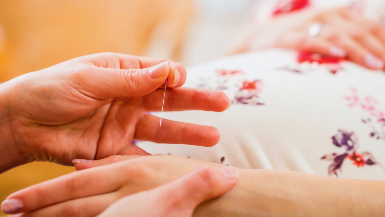 Schwangere Frau erhält Akupunktur auf den Händen