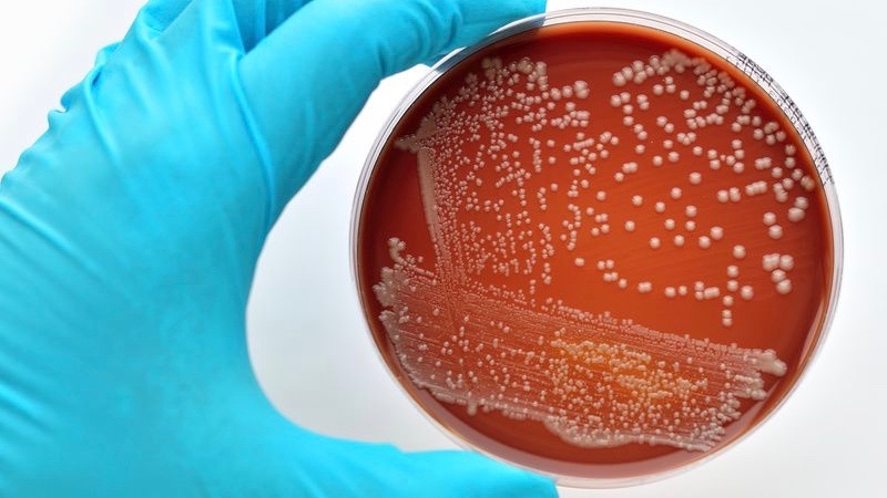 Labor Bakterienkultur eines Streptokokken-Test